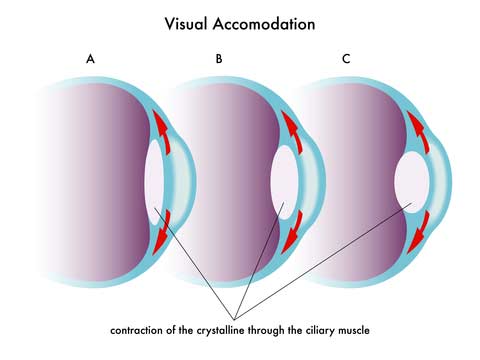 Eye Accommodation or Focusing